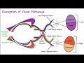 Visual Neural Pathways and Visual Field Defects