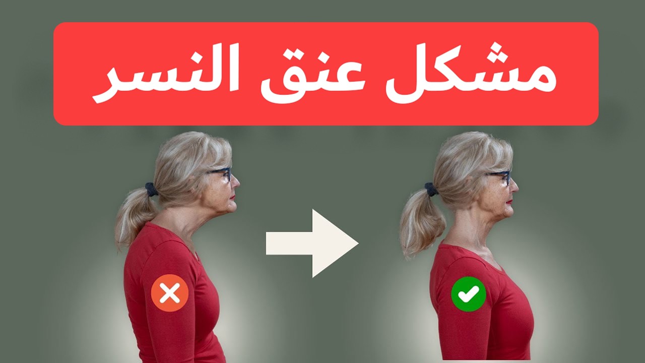 تمارين ضد مشكل تحدب أو تقوس الرقبة