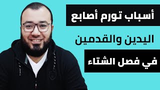 أسباب تورم أصابع اليد والقدم في الشتاء وطرق العلاج.