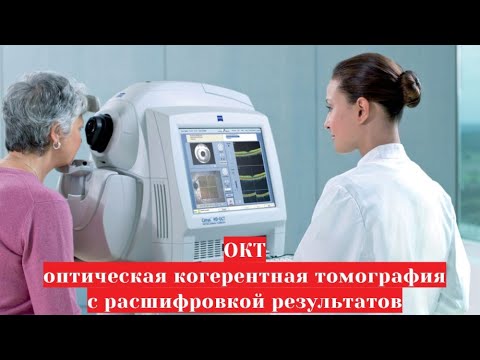 ОКТ - оптическая когерентная томография 👀 сетчатки и зрительного нерва с расшифровкой результатов