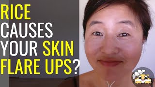 Rice causes your skin flare ups? by Hungry Gopher 246 views 1 year ago 3 minutes, 15 seconds