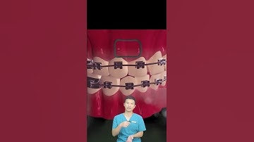 Niềng Răng Đóng Khít Khe Thưa? | Bác Sĩ Yên