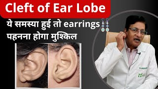 Unlocking the Secrets of Cleft Ear Lobes Causes, Complications and Treatment | Dr. Karoon Agrawal