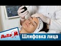 Всё о лазерной шлифовке лица. “Доктор И“