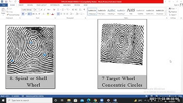 DMIT FINGER PRINT TYPES AND HOW TO SCAN BEFORE UPLOAD TRAINING