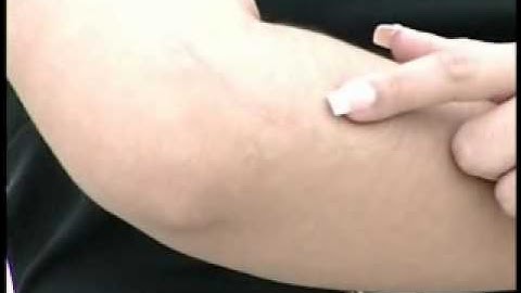 Oferta Reumarthritis