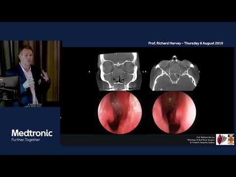 Understanding Inflammatory sinus disease, nasal polyps and chronic sinusitis -  Prof Richard Harvey