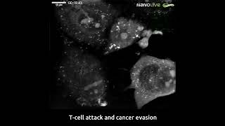 T-cell attack and cancer evasion