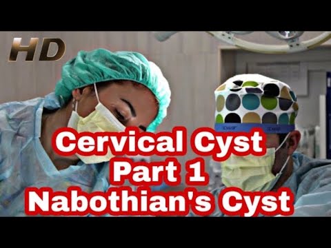 Nabothian&rsquo;s Cyst|కారణాలు, ప్రమాద కారకాలు, లక్షణాలు, రోగనిర్ధారణ & చికిత్స|ఎలక్ట్రోకాటరీ అబ్లేషన్ థెరపీ