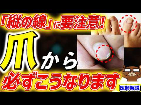 【危険】がん.感染症.栄養失調..知らないと後悔する「爪」の超意外な兆候。色.形.線..爪は内臓の不調を表す鏡だった。水虫を放置した末路は。何科を受診すべき？予防法・対処法はあるのか。医師が完全解説。