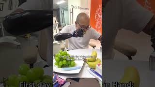 FIRST TIME eating with 2 robot hands #vulcan #prosthetics #bionic #orthotics #limbloss #disability