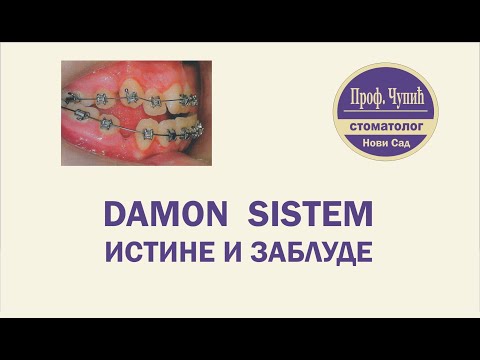 DAMON SISTEM - ISTINE I ZABLUDE, ortodont Prof. ČUPIĆ, Novi Sad