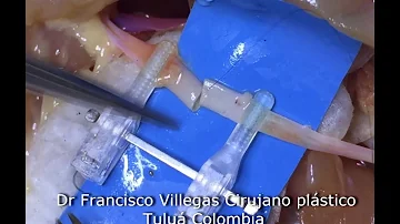 Quante sono le arterie surrenali?