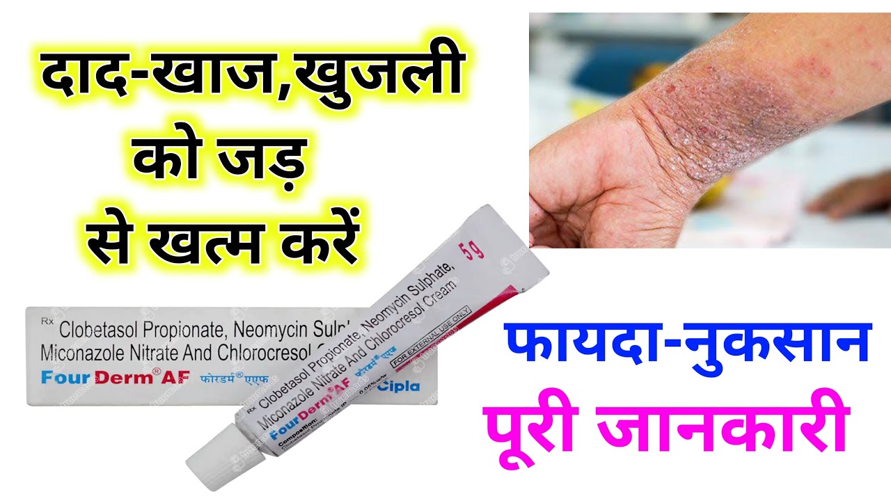 Fourderm Af cream full review in Hindi | fourderm cream ke fayde | fourderm cream uses in hindi