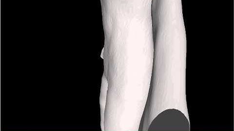 3D body modeling from a single Kinect (2)