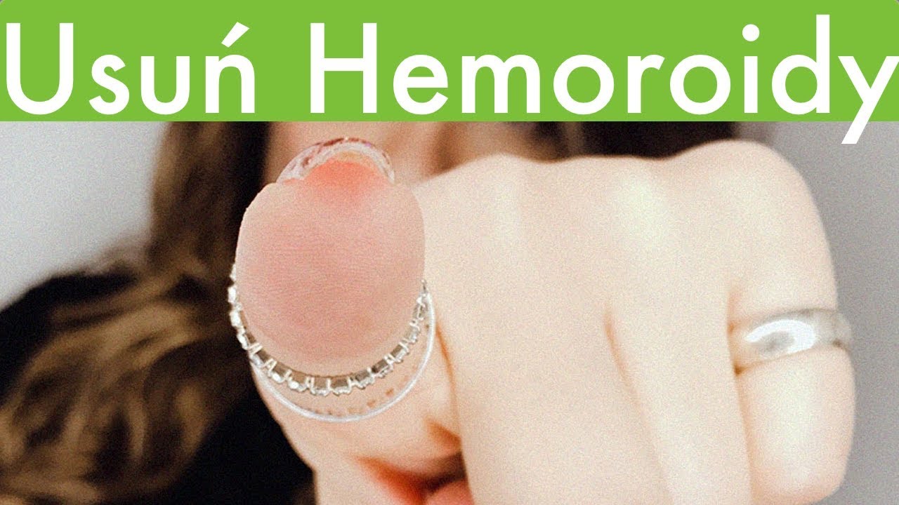 Hemoroidy Leczenie Domowy Sposob Na Hemoroidy Jak Leczyc Hemoroidy Youtube Health Youtube Thumbs Up