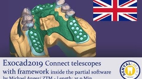 EXOCAD 2019 Tutorial Preview - Connect telescopes with framework inside the partial software