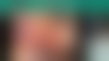 Sinusitis of dental origin