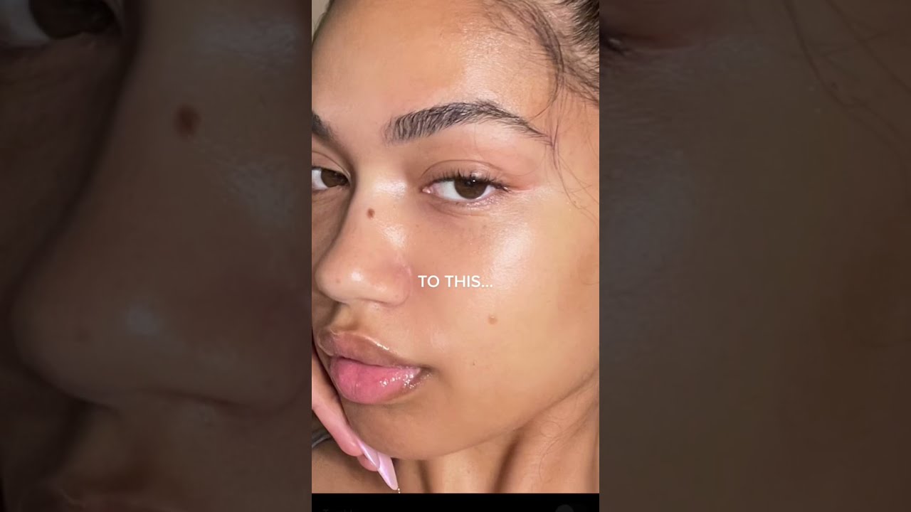 How I CLEARED My TEXTURED SKIN Got Rid Of Those Tiny Bumps On Skin 