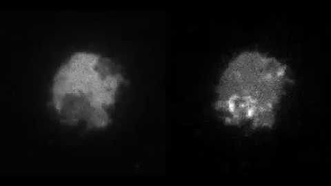 ElmoA and Actin in a Dictyostelium Amoeba