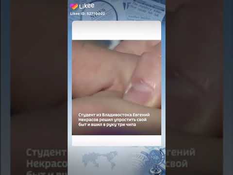 #Чепирование...