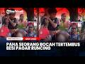 Ngilu! Paha Seorang Bocah Tertembus Besi Pagar Runcing