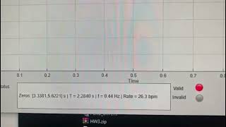 Famous numerical methods project 2 Profile