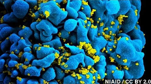 Could HIV Drugs Be The Key To Treating Multiple Sclerosis?