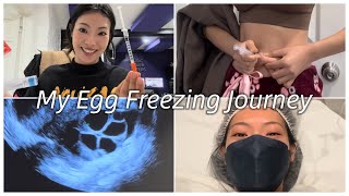 MY EGG FREEZING JOURNEY 🥚😳🤷🏻‍♀️ | Lucia Liu - (prep/cost/schedule/ultrasounds )
