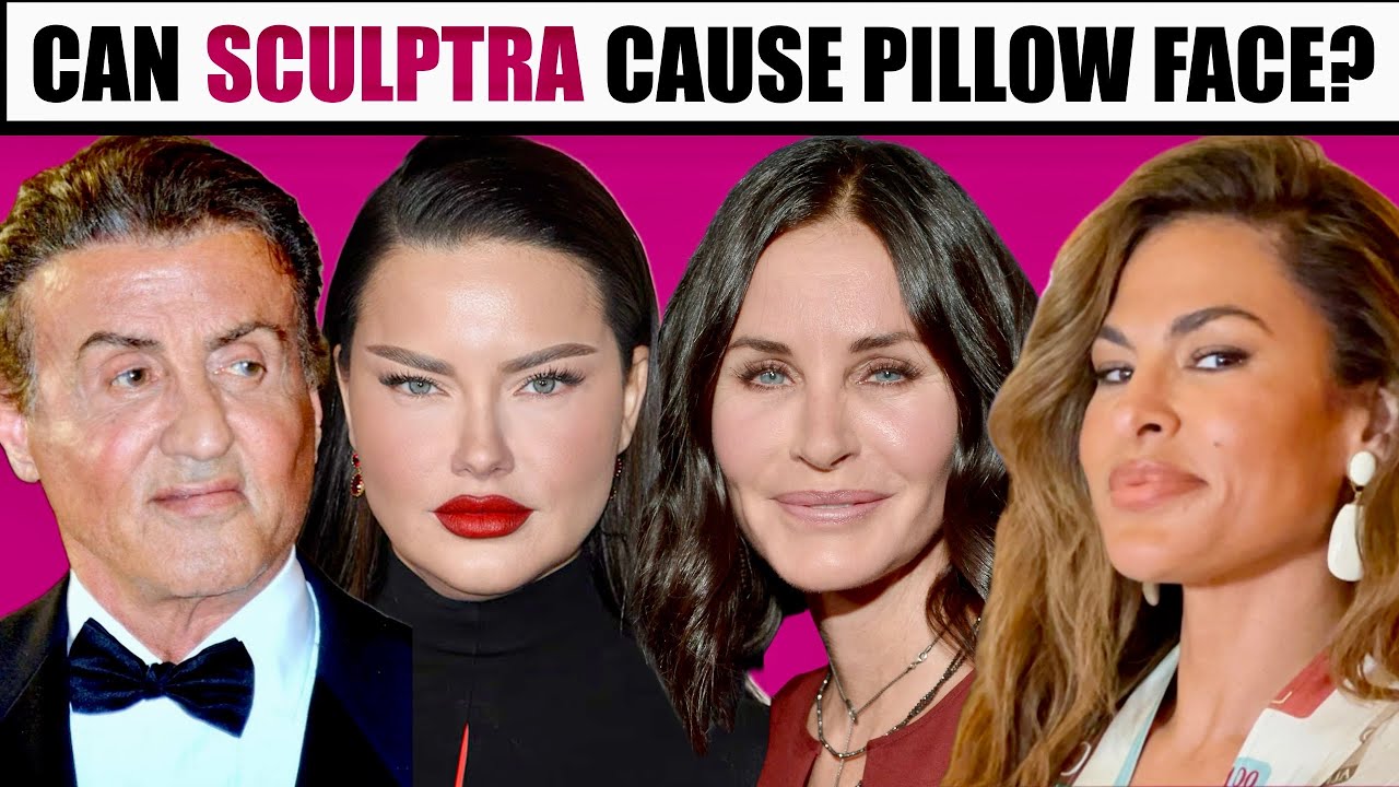 Can Sculptra Migrate and cause Pillow Face- What if I don't like my results?