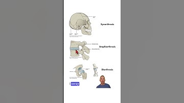 Joint Classification by Movement