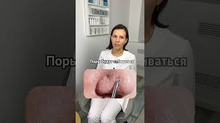 Как избавиться от черных точек на носу 🔥 рассказываю в inst 🌀tatimore_beauty