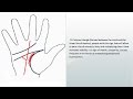 Palmistry “Palm Reading” signs of wealth, money lines | wealth lines, signs of money, wealth signs |