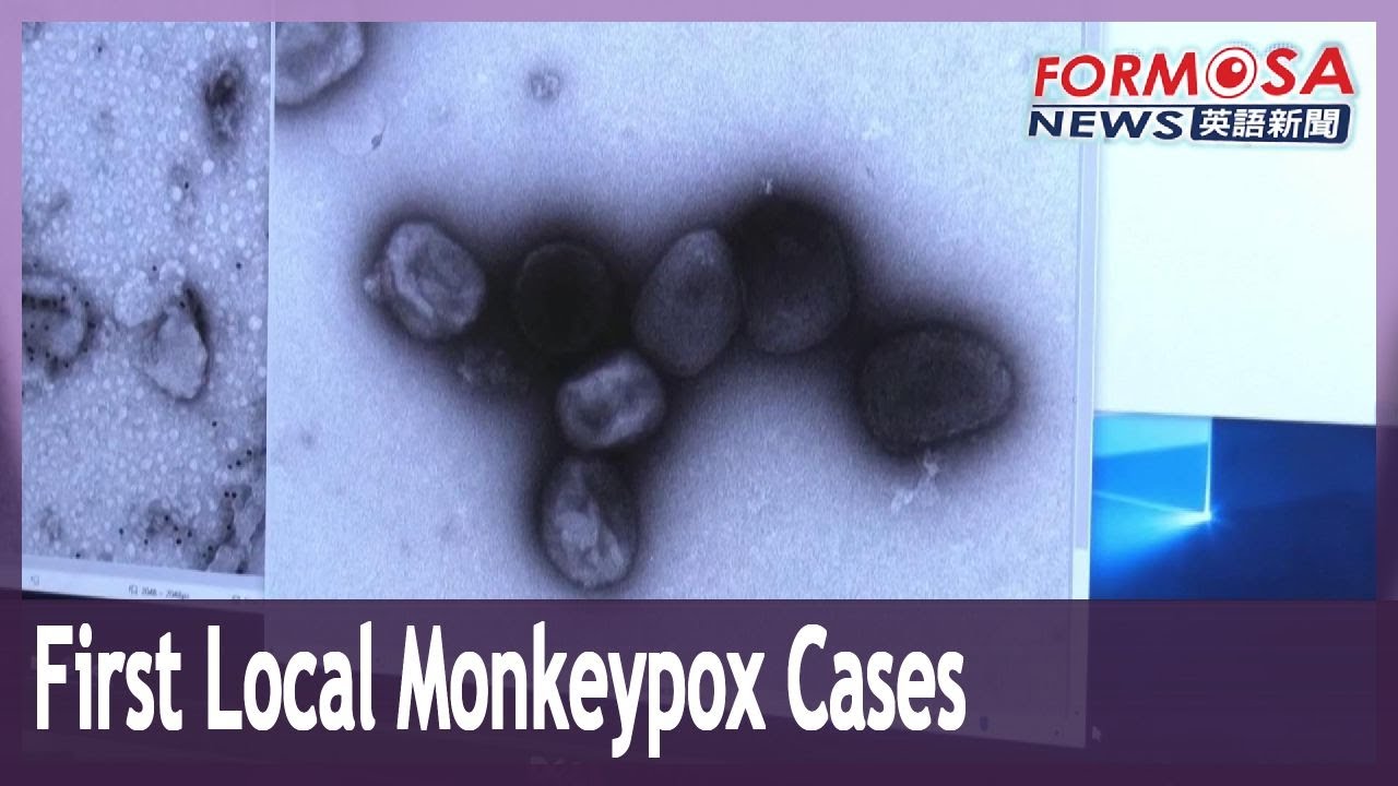 Taiwan reports first two local infections of monkeypox - YouTube