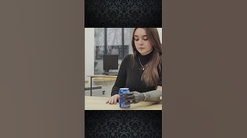 Esper Hand: Redefining Prosthetic Technology in 2023! 🖐️🌟 | Cutting-Edge Prosthetics!