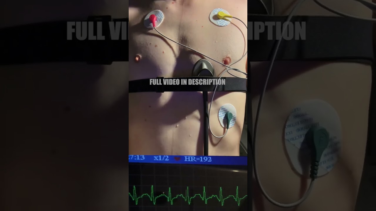 Training my heart, cardio workout🫀