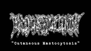Benzoylmethylecgonine - Cutaneous Mastocytosis