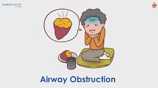 Airway Obstruction | Manipal Hospitals Bengaluru