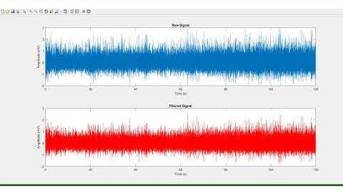 Identification of Muscle Fatigue Based on EMG Signal
