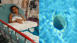 Girl Whose Insides Were Sucked From Her Body While Sitting On Pool Suction Defies Medical Odds