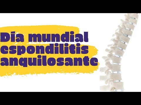 Vídeo: Manejando Su Día A Día Con Espondilitis Anquilosante