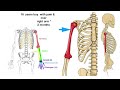 Humerus or Shoulder or Arm bone Tumor  Surgery