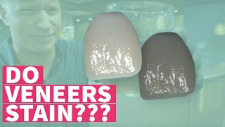 Do Dental Veneers Stain? - Expert in Cosmetic Dentistry, Dr. O Shows Amazing Results!