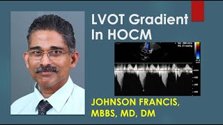 LVOT Gradient In HOCM