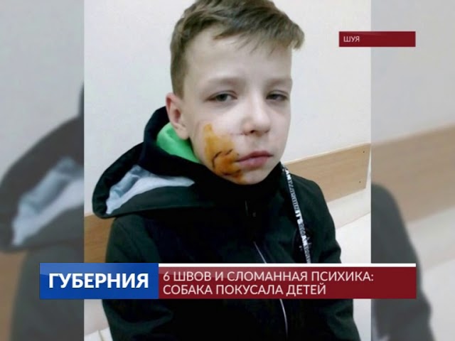 6 швов и сломанная психика: собака покусала детей