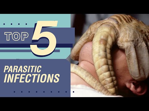 TOP 5 Parasitic Infections