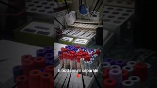 blood serum separate 🩸...#bloodtest #medicaltest #bloodtest #serum #separate #subscribemychannel