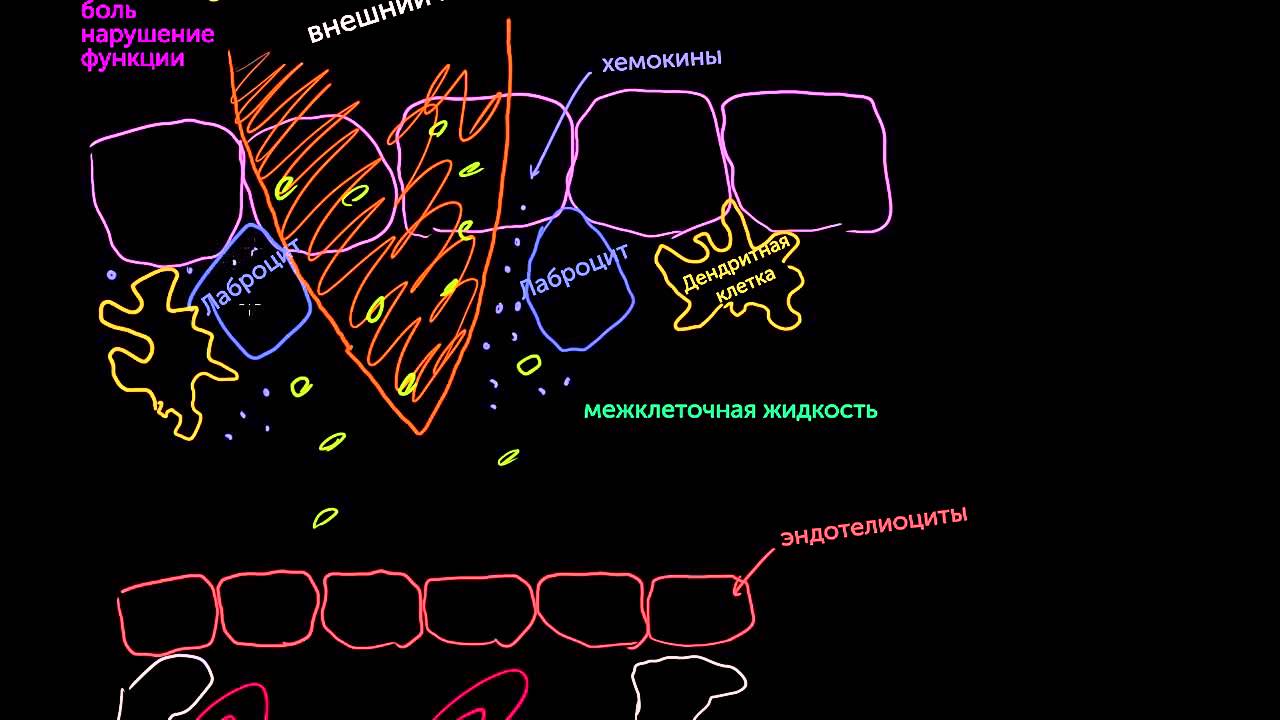 Воспалительная реакция