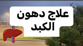 علاج دهون الكبد