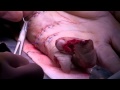 Operating on a severed hand  bizarre er